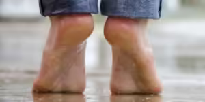 Hiperhidrosis plantar sudor pies