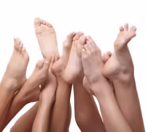 sudor pies hiperhidrosis