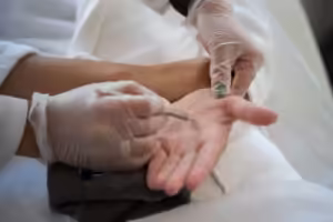 tratamiento hiperhidrosis palmar