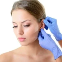 Otoplastia en Barrancabermeja otoplastia barrancabermeja